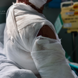 fairfax virginia severe burn injury lawyers, catastrophic injury attorney fairfax, personal injury lawyer fairfax virginia