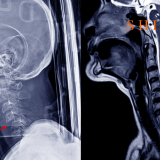 neck injury lawyer Virginia, whiplash injury attorney Virginia, cervical spine injury claim Virginia, car accident neck injury Virginia, soft tissue injury lawyer Virginia, rear end collision neck injury Virginia, proving neck injury Virginia law, Virginia personal injury neck pain, chiropractic testimony Virginia injury case, Virginia whiplash settlement, neck injury lawsuit Virginia, cervical disc injury attorney Virginia, neck injury damages Virginia, Virginia accident injury lawyer, pain and suffering neck injury Virginia